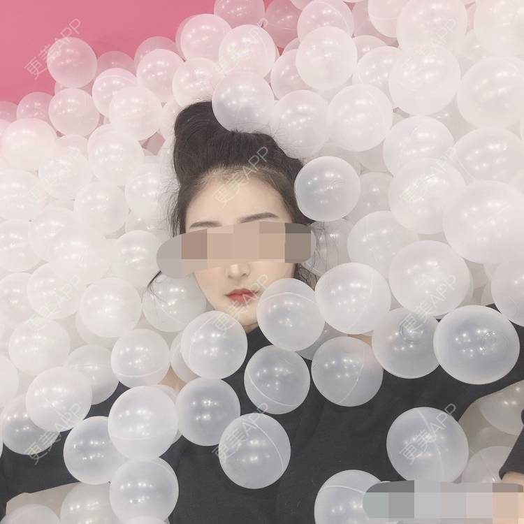 更美 - 更美用户oxU0xpBRZG的激光脱发际线经验 | 激光脱发际线 | 上海