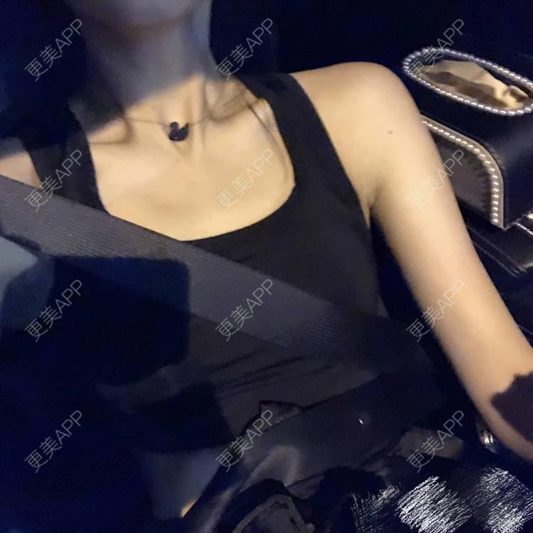 更美 - 更美用户oxU0xpBRZG的激光脱发际线经验 | 激光脱发际线 | 上海