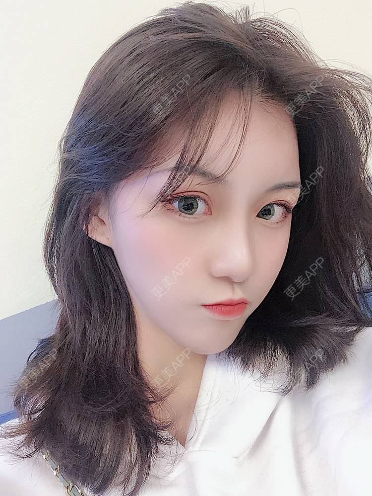 更美用户Z8LC2qZQ6m的双眼皮日记