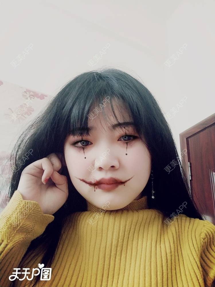 更美 - 更美用户4iauBWvNyf的玻尿酸苹果肌经验 | 玻尿酸苹果肌 | 玻尿酸太阳穴 | 玻尿酸唇部 | 玻尿酸面部细纹 | 玻尿酸耳垂 | 保定