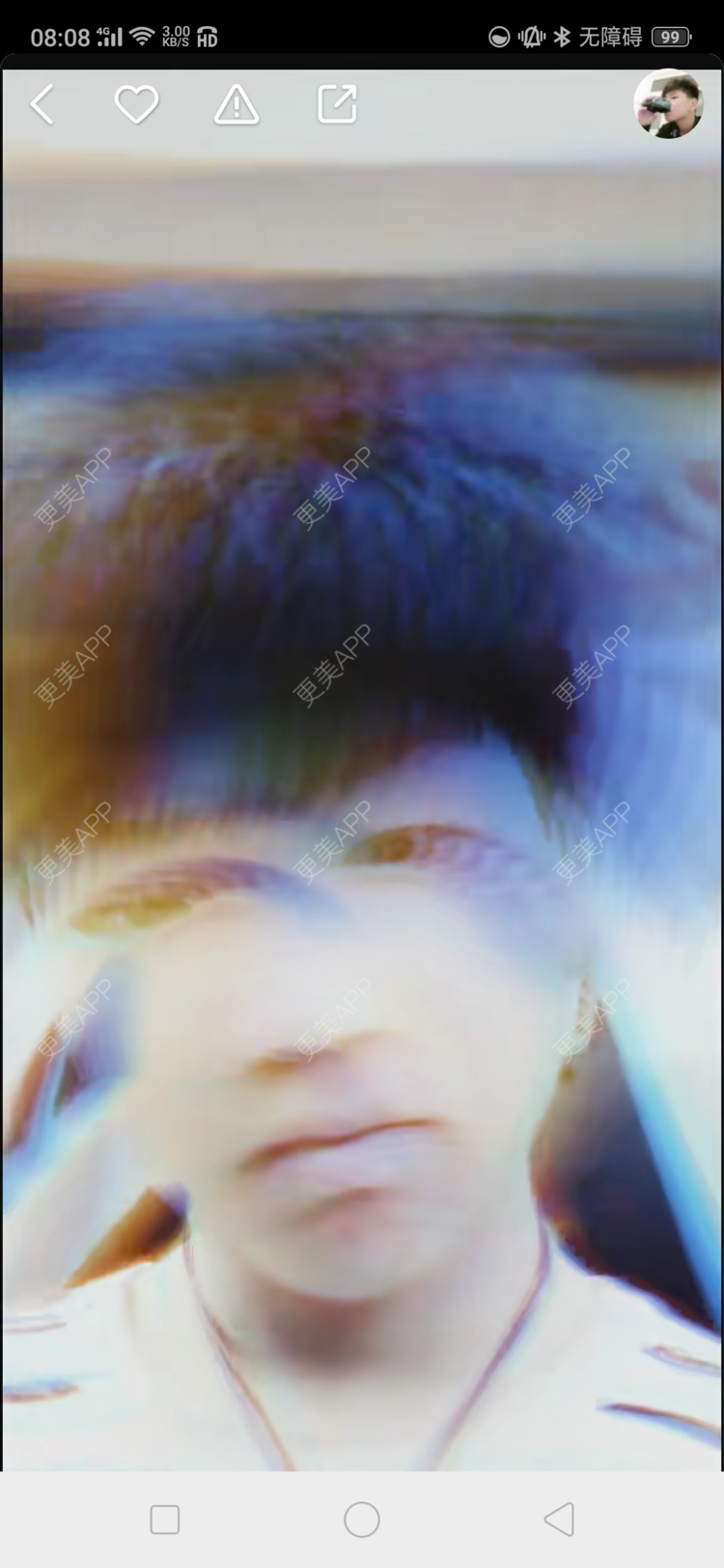 更美 - 更美用户4iauBWvNyf的玻尿酸苹果肌经验 | 玻尿酸苹果肌 | 玻尿酸太阳穴 | 玻尿酸唇部 | 玻尿酸面部细纹 | 玻尿酸耳垂 | 保定