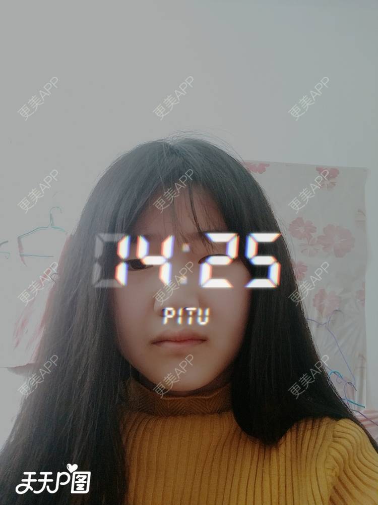 更美 - 更美用户4iauBWvNyf的玻尿酸苹果肌经验 | 玻尿酸苹果肌 | 玻尿酸太阳穴 | 玻尿酸唇部 | 玻尿酸面部细纹 | 玻尿酸耳垂 | 保定