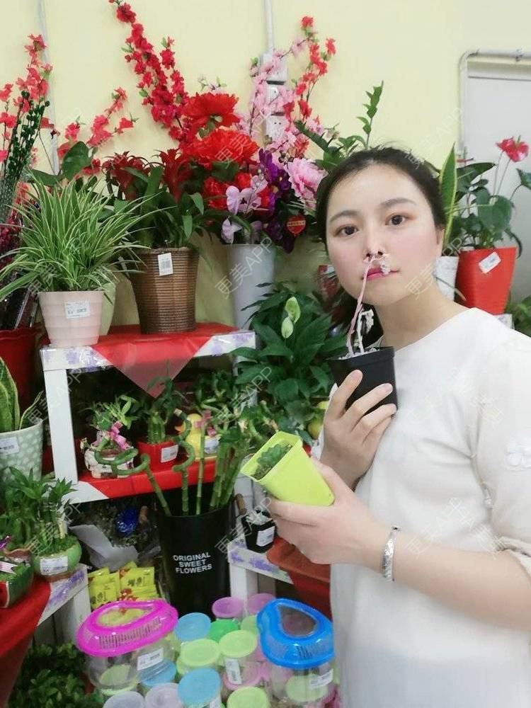 更美 - 更美用户9u5o246DCv的黄金微针经验 | 黄金微针 | 视频日记 | 佛山