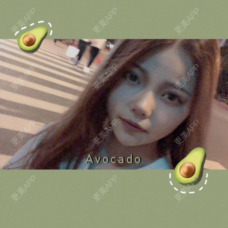 更美 - . Kylla rrrrr🔻的玻尿酸下巴经验 | 玻尿酸下巴 | 上海 | 玻尿酸面颊