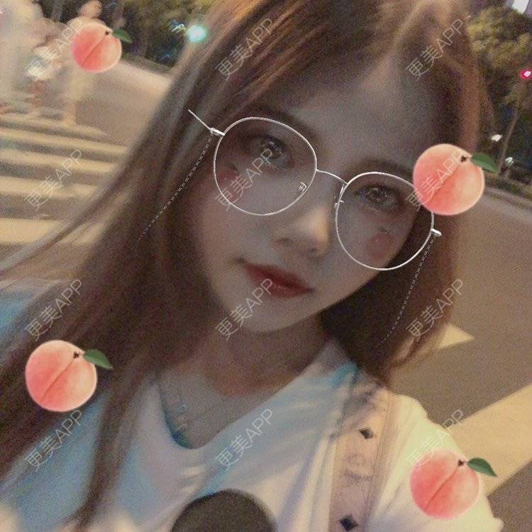 更美 - . Kylla rrrrr🔻的玻尿酸下巴经验 | 玻尿酸下巴 | 上海 | 玻尿酸面颊