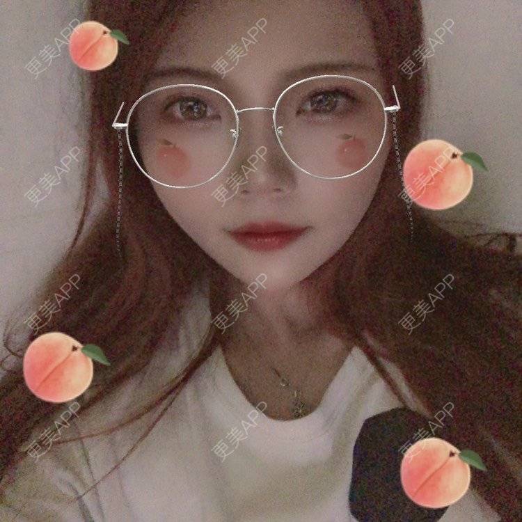 更美 - . Kylla rrrrr🔻的玻尿酸下巴经验 | 玻尿酸下巴 | 上海 | 玻尿酸面颊