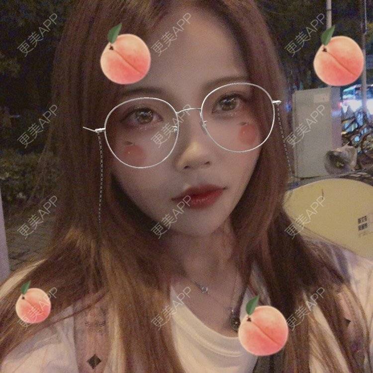 更美 - . Kylla rrrrr🔻的玻尿酸下巴经验 | 玻尿酸下巴 | 上海 | 玻尿酸面颊