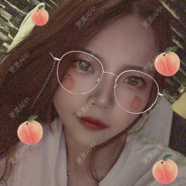 更美 - . Kylla rrrrr🔻的玻尿酸下巴经验 | 玻尿酸下巴 | 上海 | 玻尿酸面颊