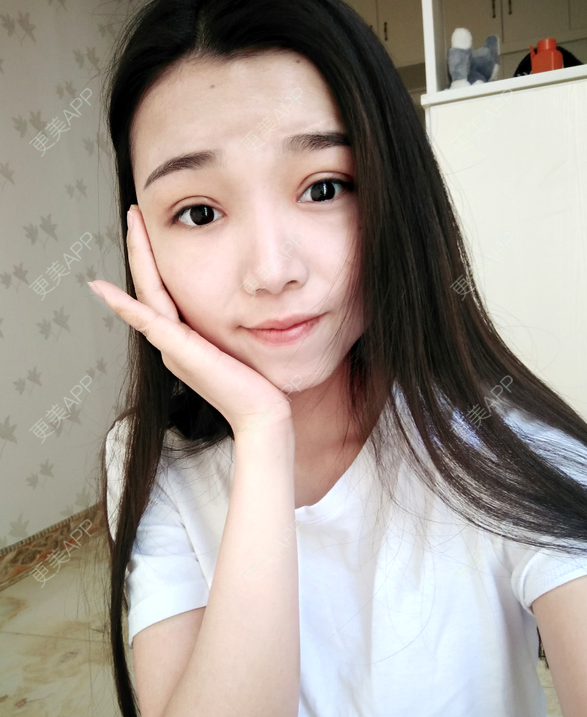 信么予我孤独的切开双眼皮日记