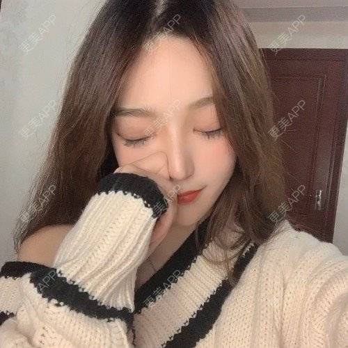 更美 - 更美用户iUgxHIc5fy的自体脂肪丰苹果肌经验 | 自体脂肪丰苹果肌 | 自体脂肪丰太阳穴 | 自体脂肪丰额头 | 武汉