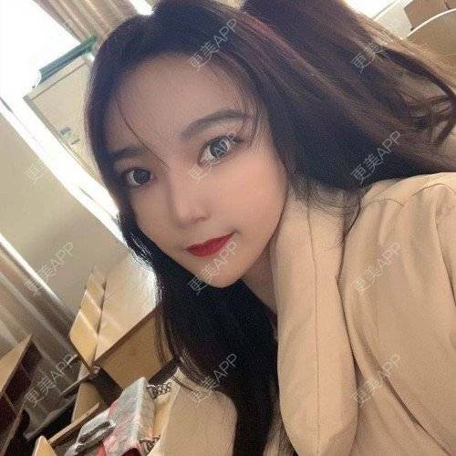 更美 - 更美用户iUgxHIc5fy的自体脂肪丰苹果肌经验 | 自体脂肪丰苹果肌 | 自体脂肪丰太阳穴 | 自体脂肪丰额头 | 武汉