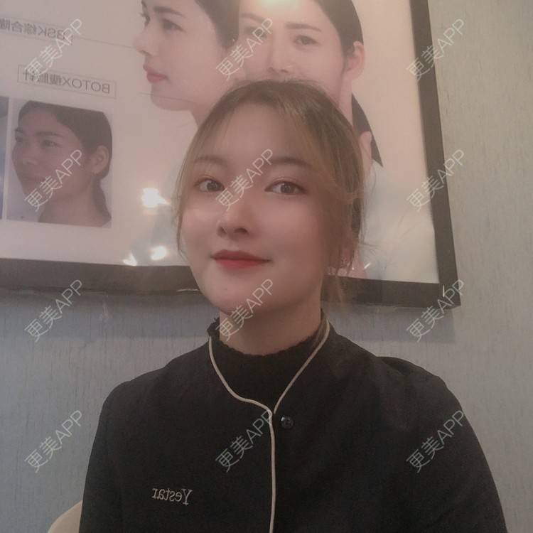 更美 - 更美用户Qx4QKwu9t2的手术缩鼻头经验 | 手术缩鼻头 | 鼻小柱延长 | 自体软骨垫鼻尖 | 长沙