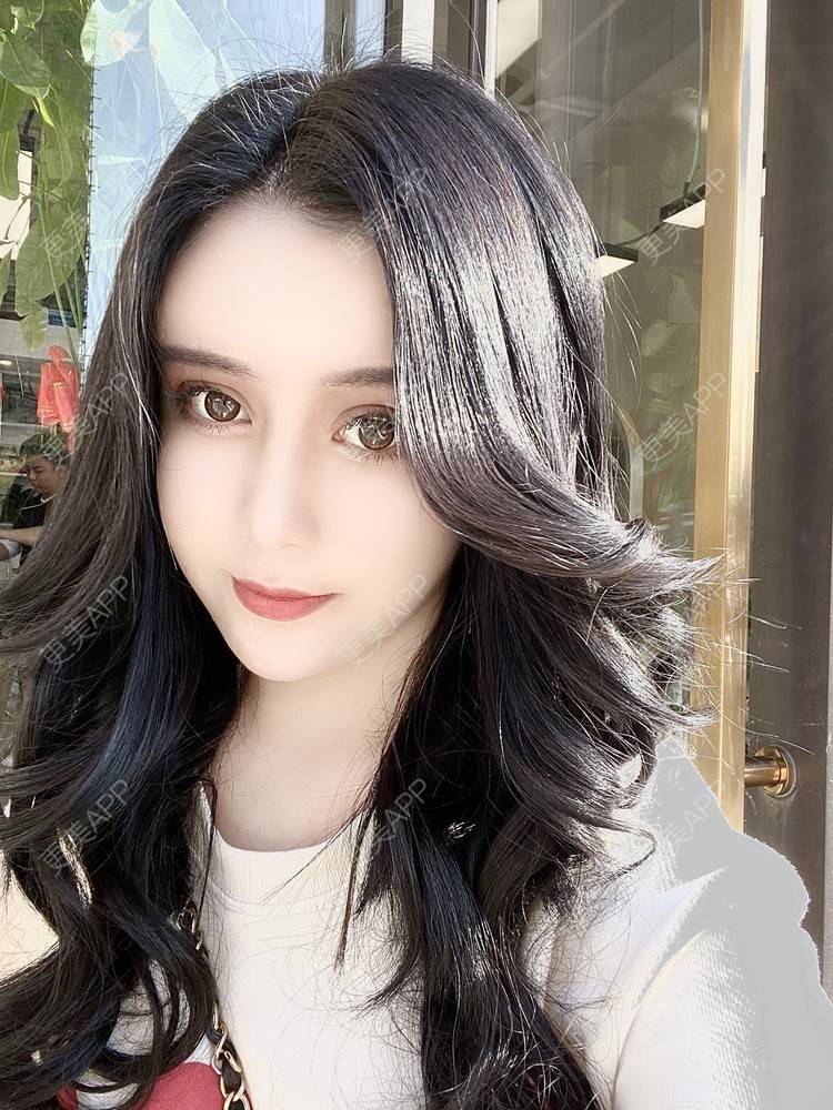 更美 - 更美用户XbSPRKDbDj的自体脂肪填充泪沟经验 | 自体脂肪丰额头 | 自体脂肪丰苹果肌 | 自体脂肪丰太阳穴 | 自体脂肪垫眉弓 | 自体脂肪填充泪沟 | 武汉