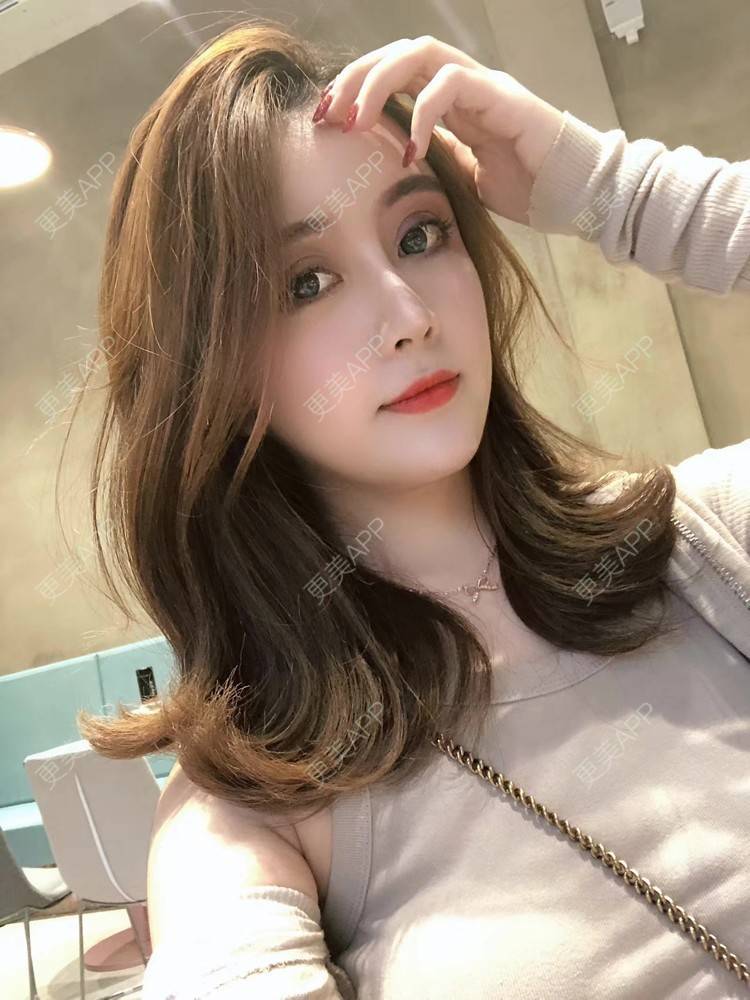 更美 - 更美用户XbSPRKDbDj的自体脂肪填充泪沟经验 | 自体脂肪丰额头 | 自体脂肪丰苹果肌 | 自体脂肪丰太阳穴 | 自体脂肪垫眉弓 | 自体脂肪填充泪沟 | 武汉