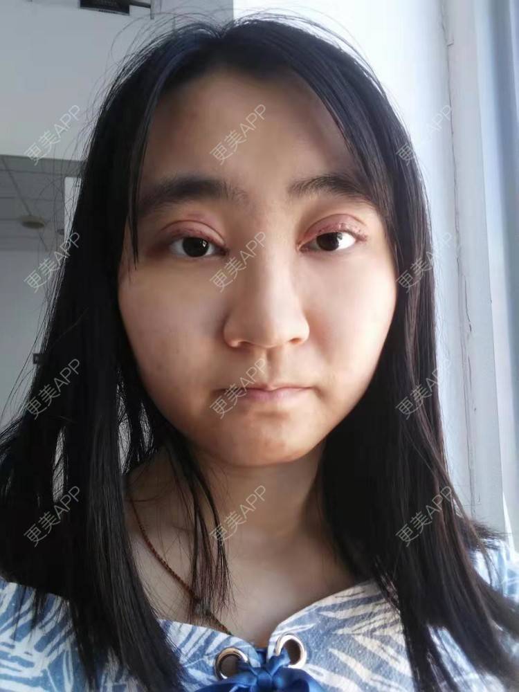 更美 - 你的女朋友的眼部多项经验 | 眼部多项 | 铜川