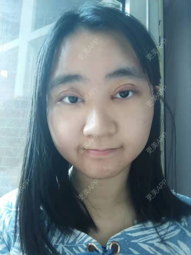 更美 - 你的女朋友的眼部多项经验 | 眼部多项 | 铜川