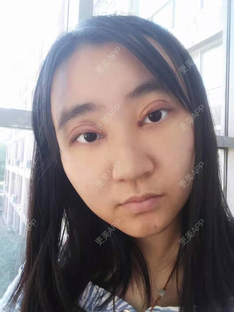 更美 - 你的女朋友的眼部多项经验 | 眼部多项 | 铜川