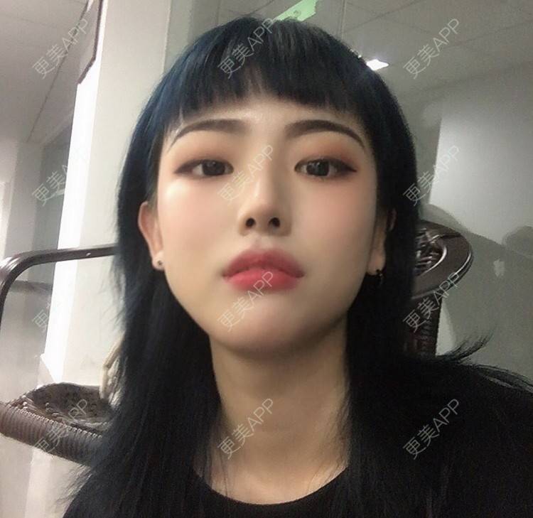 兔牙喵喵喵的光子嫩肤日记