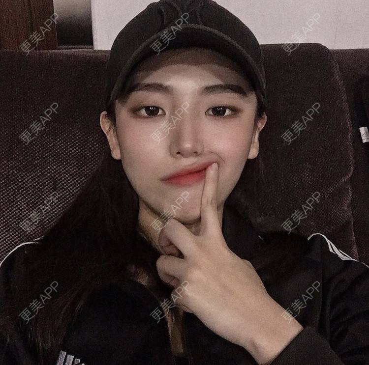 兔牙喵喵喵的光子嫩肤日记