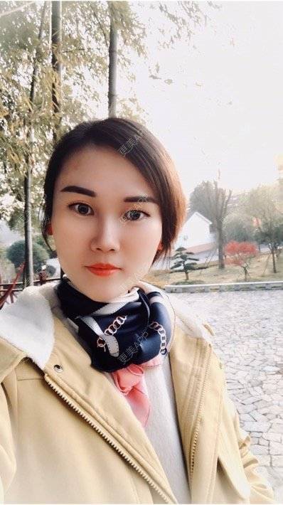 更美 - 安迪🌷的玻尿酸面颊经验 | 上海 | 玻尿酸面颊