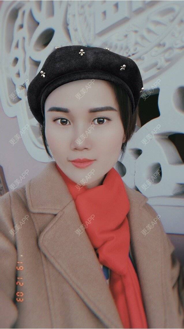 更美 - 安迪🌷的玻尿酸面颊经验 | 上海 | 玻尿酸面颊