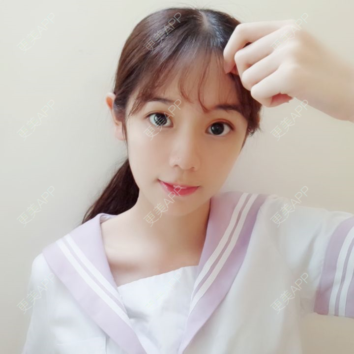 琛琛少女的切开双眼皮日记