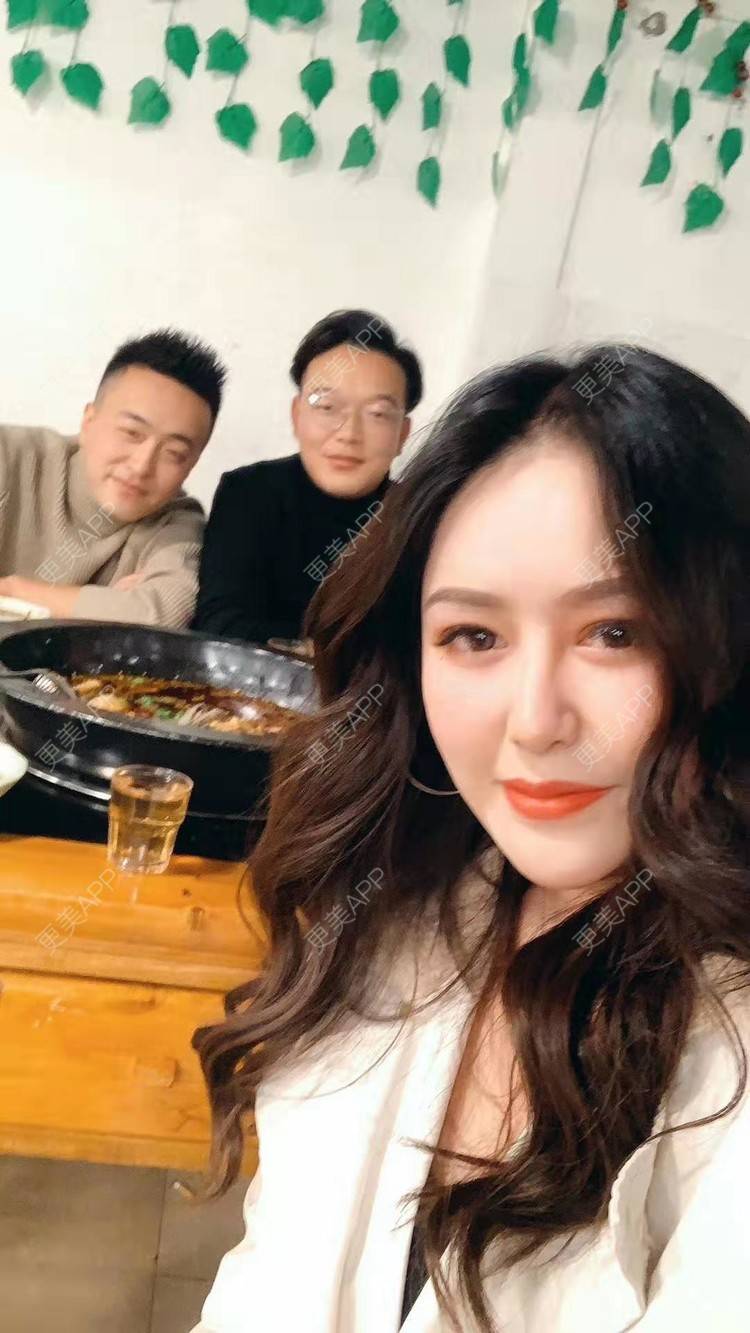 更美 - 更美用户dapPewZ45A的自体脂肪丰额头经验 | 自体脂肪丰额头 | 重庆