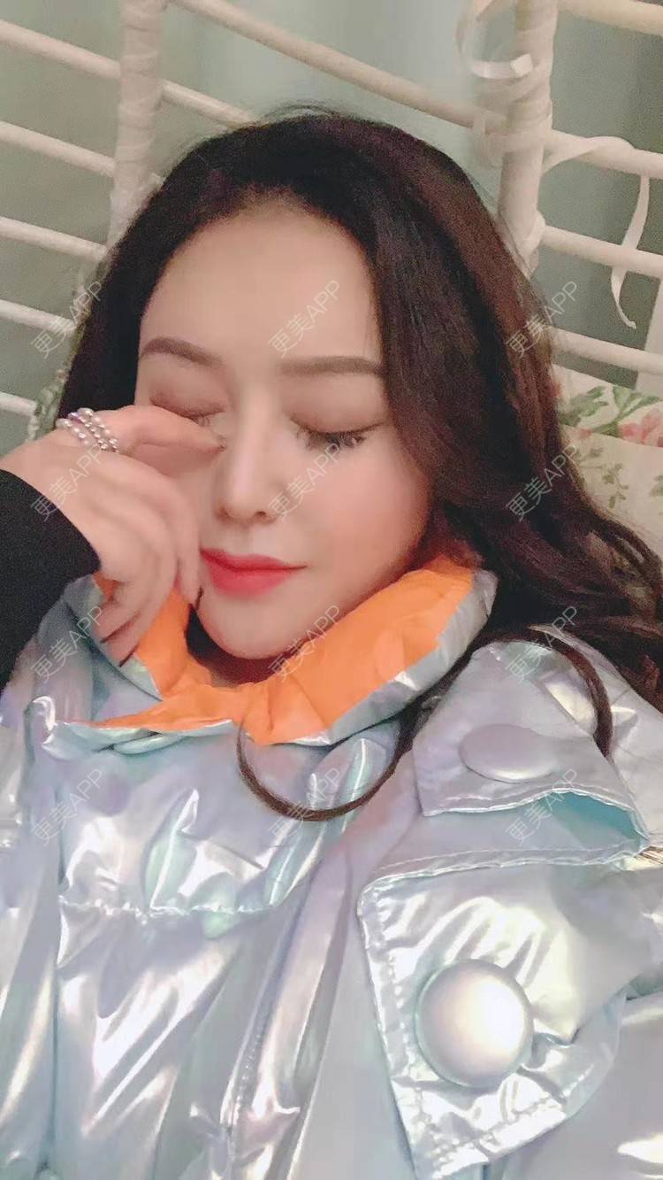 更美 - 更美用户dapPewZ45A的自体脂肪丰额头经验 | 自体脂肪丰额头 | 重庆