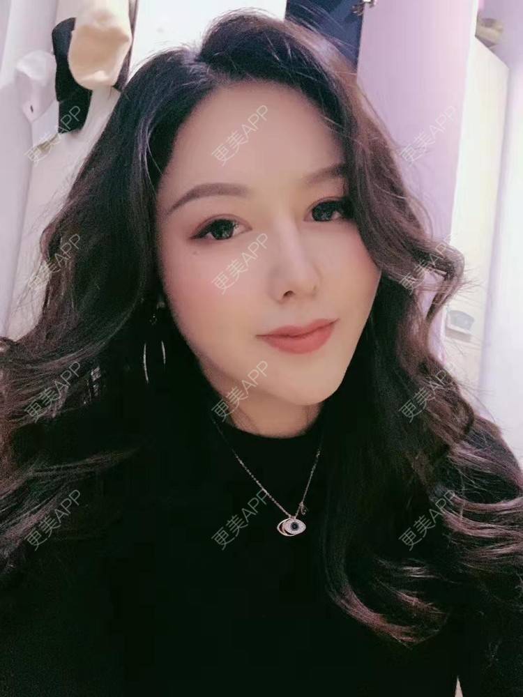 更美 - 更美用户dapPewZ45A的自体脂肪丰额头经验 | 自体脂肪丰额头 | 重庆