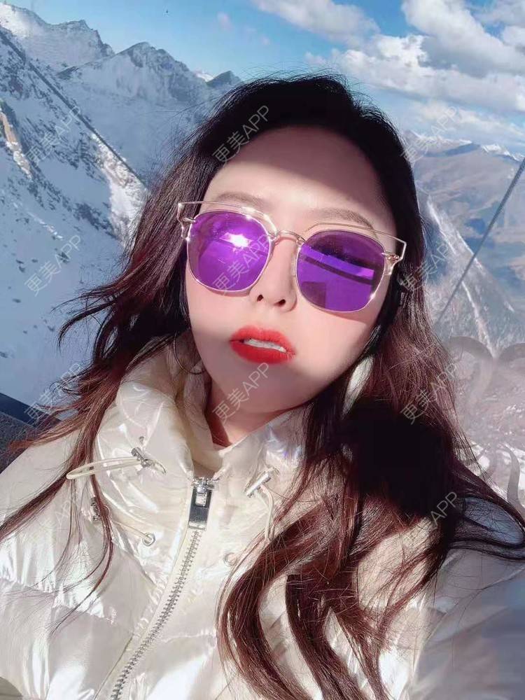 更美 - 更美用户dapPewZ45A的自体脂肪丰额头经验 | 自体脂肪丰额头 | 重庆