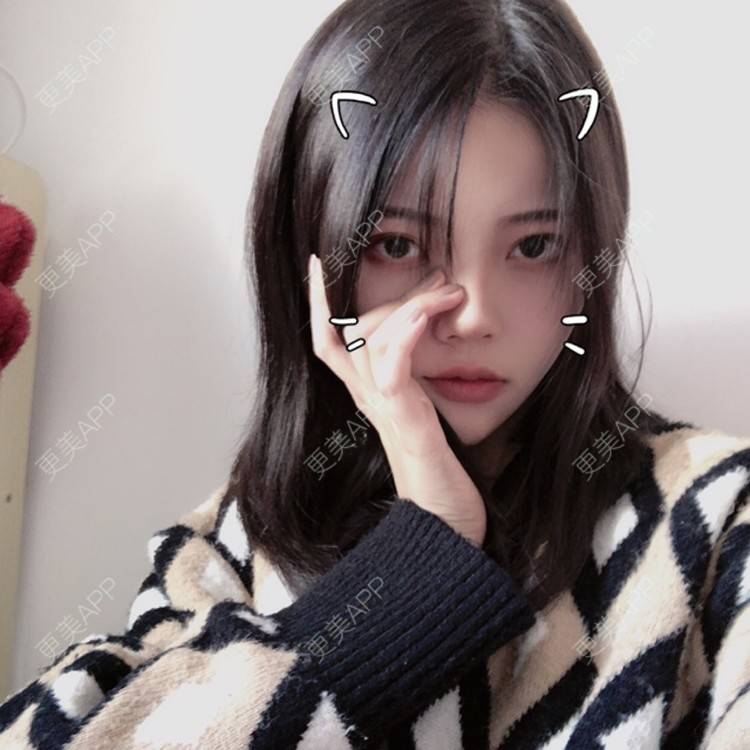 更美 - . Kylla rrrrr🔻的玻尿酸面颊经验 | 上海 | 玻尿酸面颊