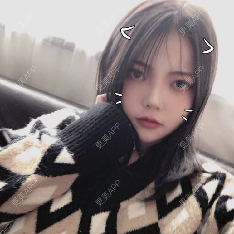 更美 - . Kylla rrrrr🔻的玻尿酸面颊经验 | 上海 | 玻尿酸面颊