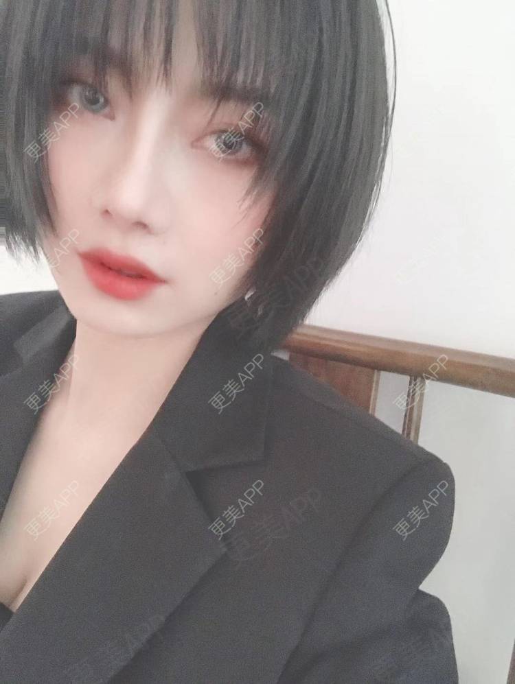 更美 - 更美用户R8DRI4045X的鼻部多项经验 | 成都 | 鼻部多项