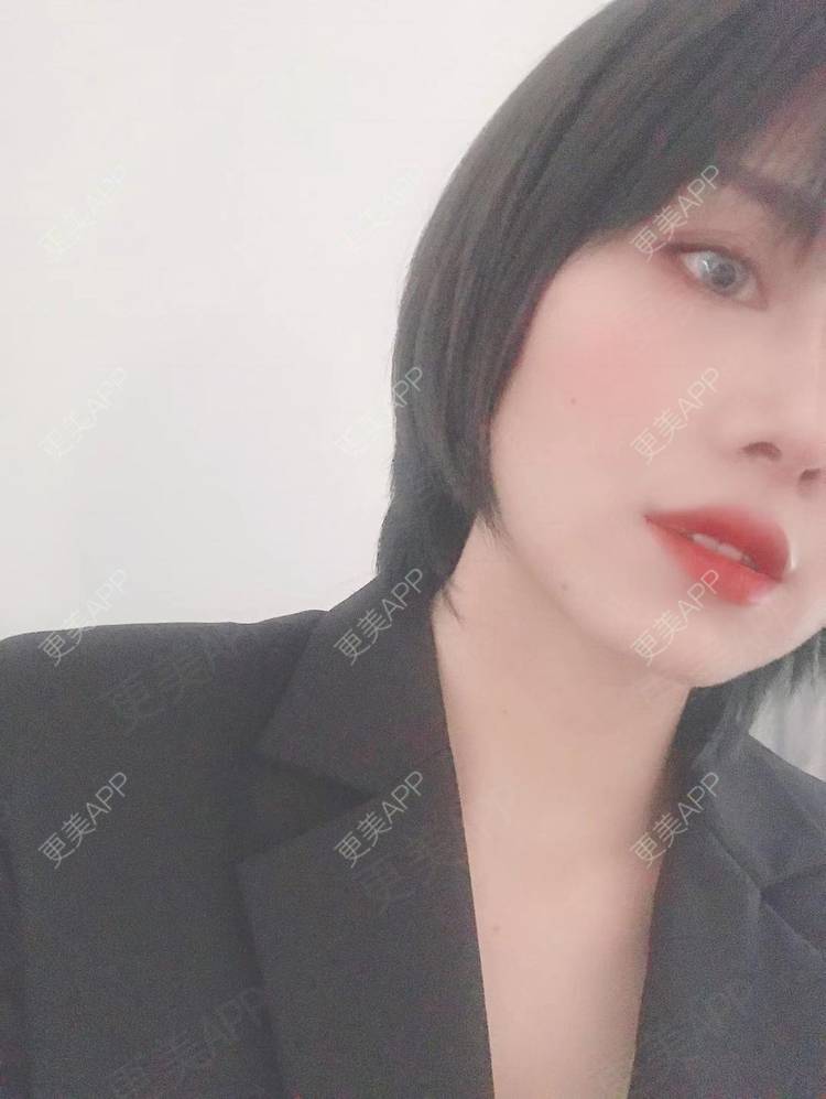 更美 - 更美用户R8DRI4045X的鼻部多项经验 | 成都 | 鼻部多项