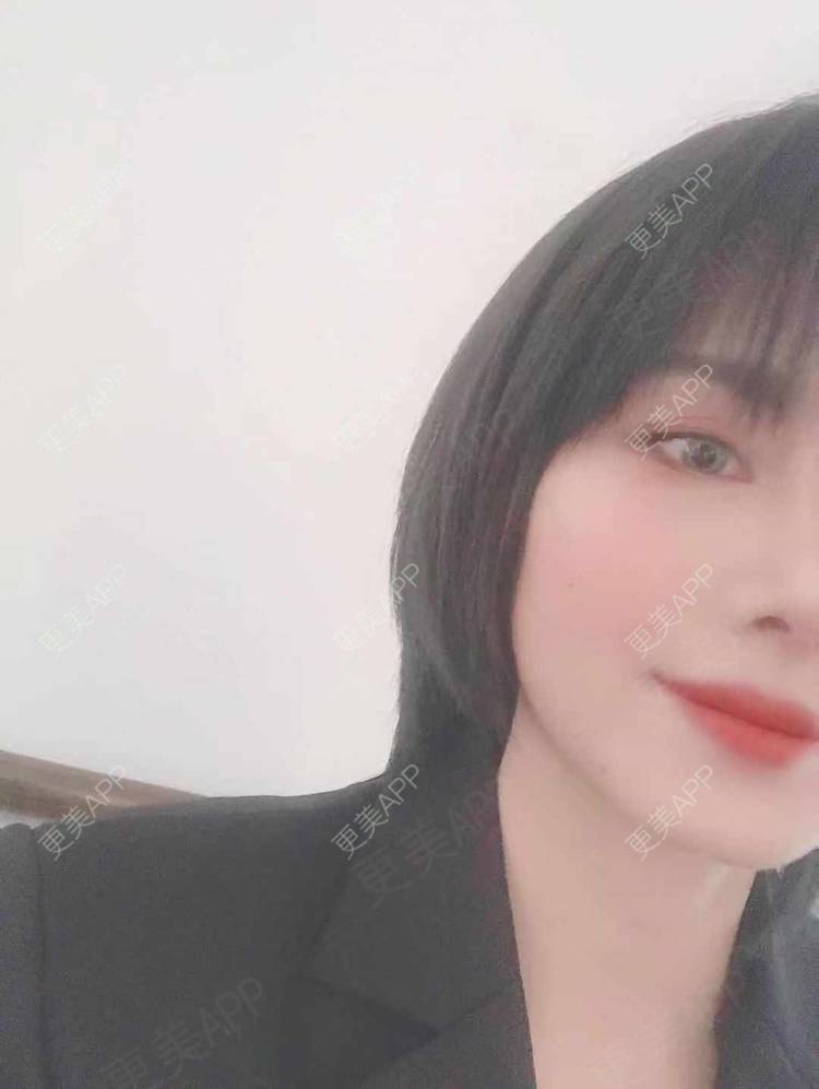 更美 - 更美用户R8DRI4045X的鼻部多项经验 | 成都 | 鼻部多项