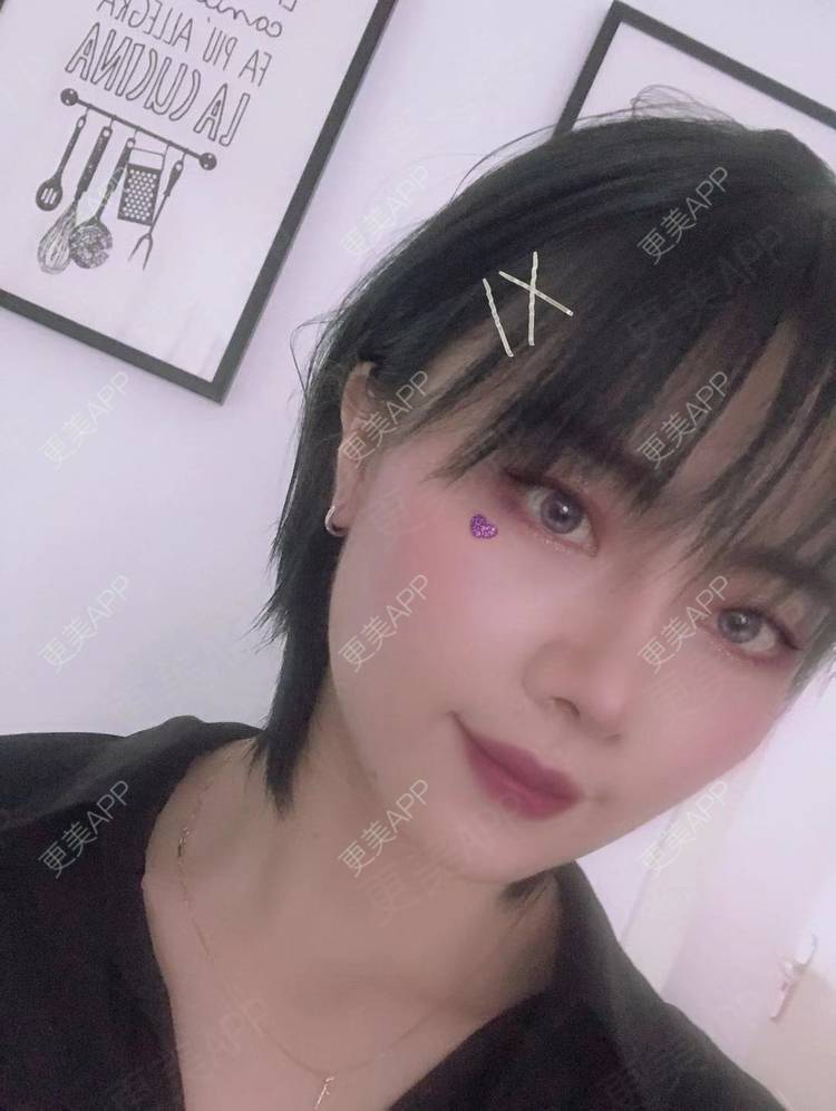 更美 - 更美用户R8DRI4045X的鼻部多项经验 | 成都 | 鼻部多项