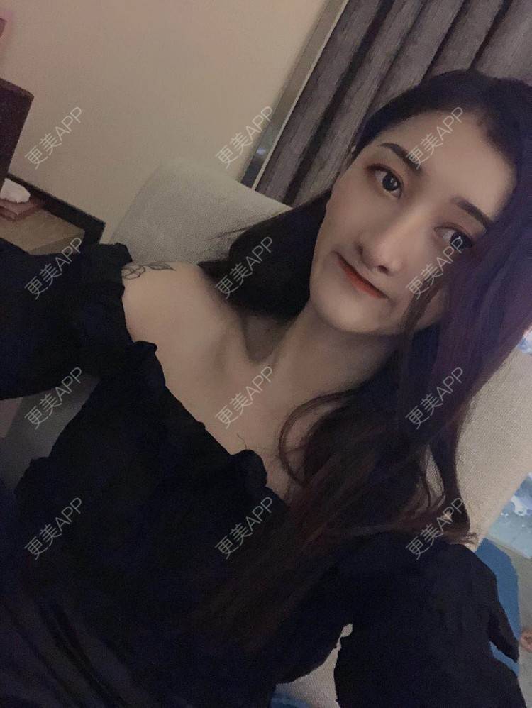 更美 - 最美的期待i的鼻形态修复经验 | 广州 | 鼻形态修复