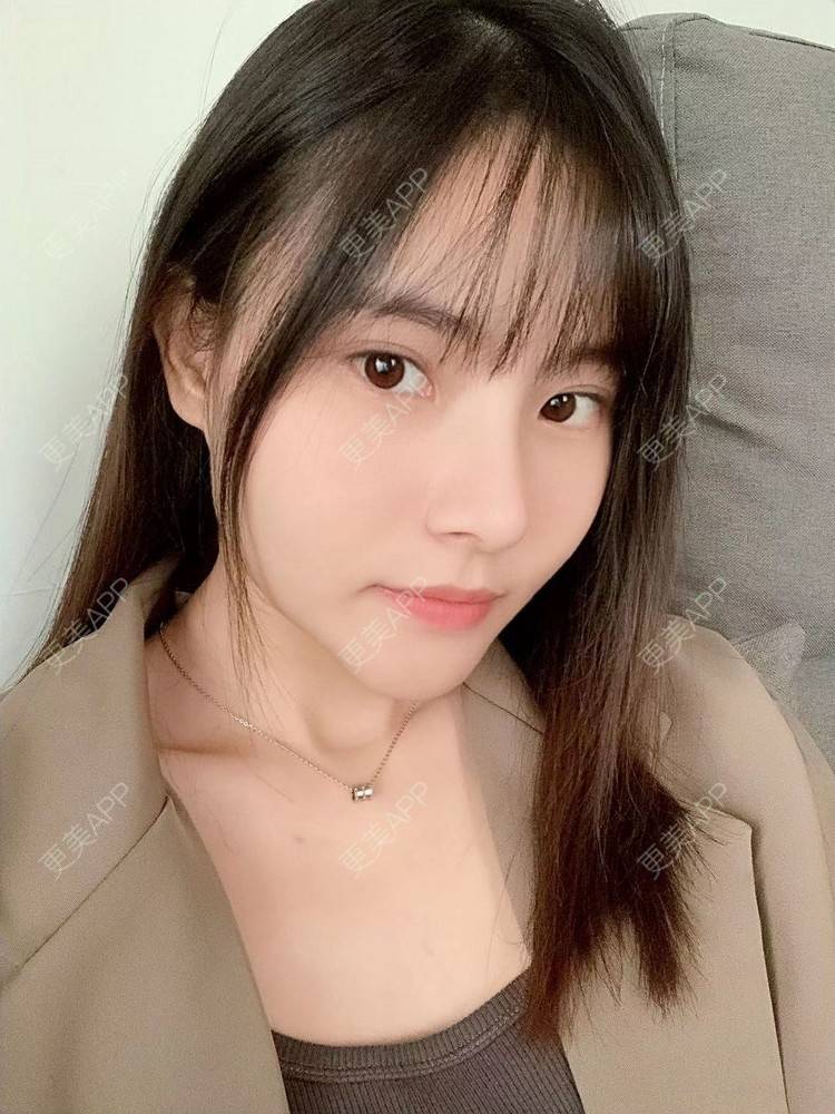 更美 - 大美人图的自体脂肪丰额头经验 | 更美研究所 | 杭州 | 下巴 | 自体脂肪丰额头