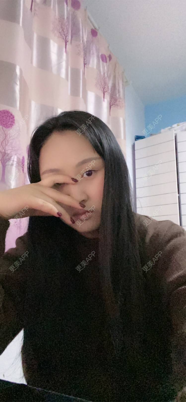 更美 - 涅槃之旅的激光紧缩阴道经验 | 上海 | 激光紧缩阴道