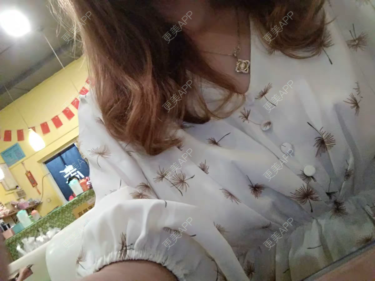 更美 - 海绵宝宝是海绵的处女膜修复经验 | 紧缩阴道 | 处女膜修复 | 上海