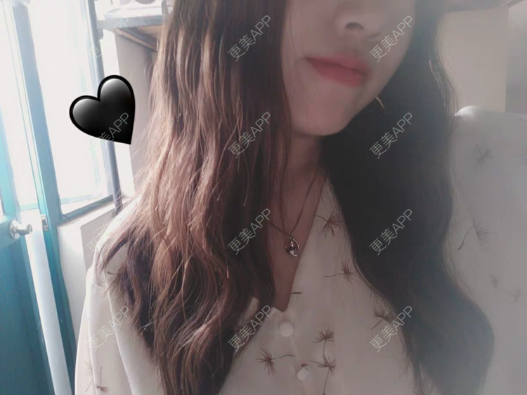 更美 - 海绵宝宝是海绵的处女膜修复经验 | 处女膜修复 | 上海 | 紧缩阴道