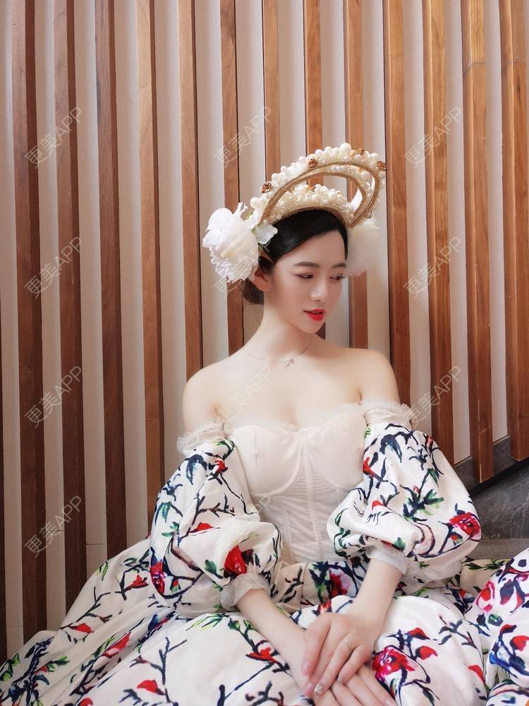 更美 - 倩倩吖的自体脂肪填充泪沟经验 | 自体脂肪丰面颊 | 自体脂肪丰太阳穴 | 美白嫩肤 | 自体脂肪填充泪沟 | 自体脂肪丰苹果肌 | 武汉 | 自体脂肪全面部填充 | 自体脂肪面部填充