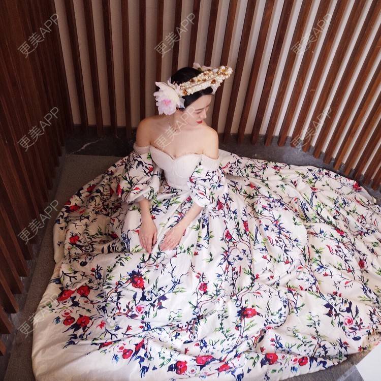 更美 - 倩倩吖的自体脂肪填充泪沟经验 | 自体脂肪丰面颊 | 自体脂肪丰太阳穴 | 美白嫩肤 | 自体脂肪填充泪沟 | 自体脂肪丰苹果肌 | 武汉 | 自体脂肪全面部填充 | 自体脂肪面部填充