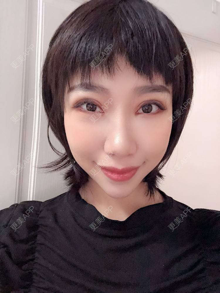 更美 - 🍬肉肉肉肉丝的下巴经验 | 下巴 | 硅胶垫下巴 | 哈尔滨