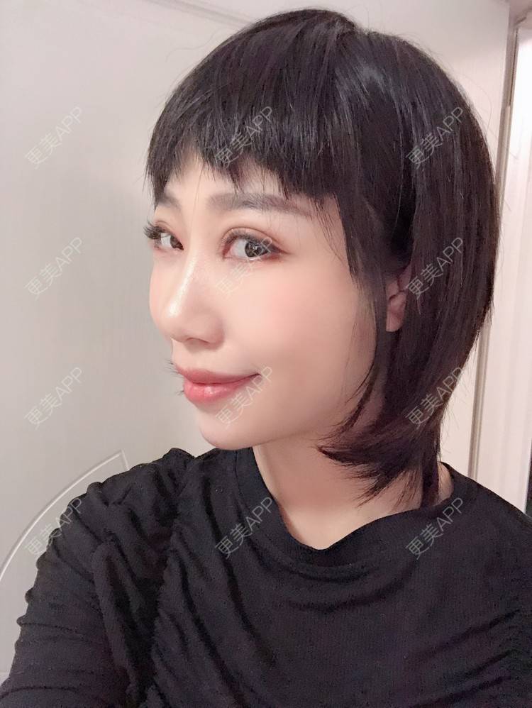 更美 - 🍬肉肉肉肉丝的下巴经验 | 下巴 | 硅胶垫下巴 | 哈尔滨
