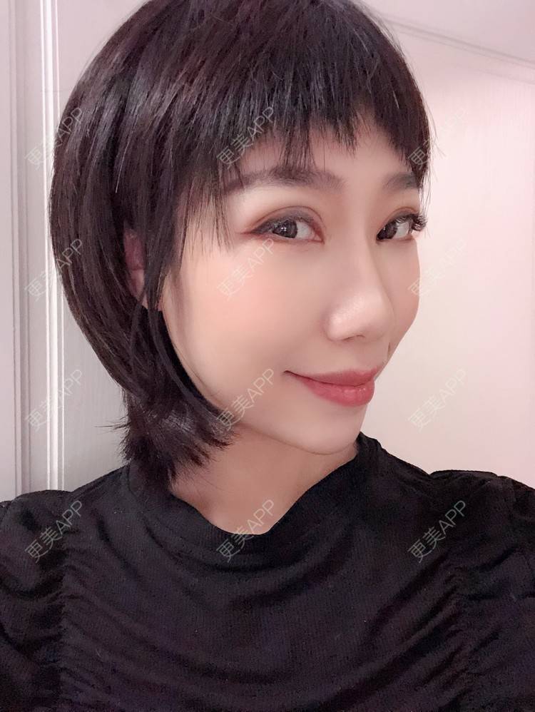 更美 - 🍬肉肉肉肉丝的下巴经验 | 下巴 | 硅胶垫下巴 | 哈尔滨