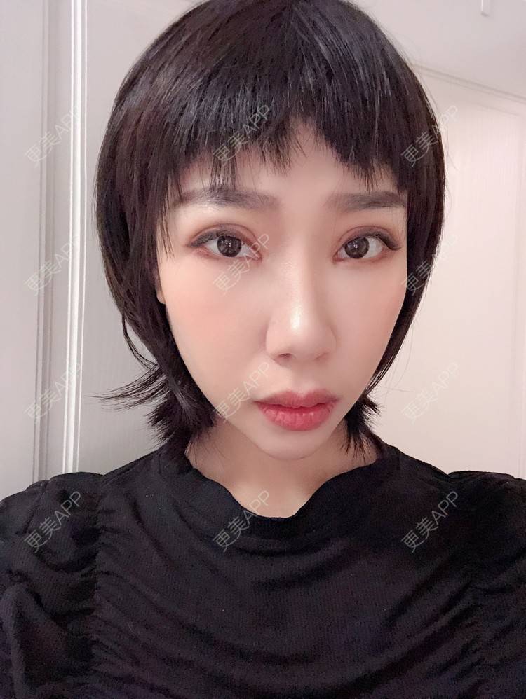 更美 - 🍬肉肉肉肉丝的下巴经验 | 下巴 | 硅胶垫下巴 | 哈尔滨