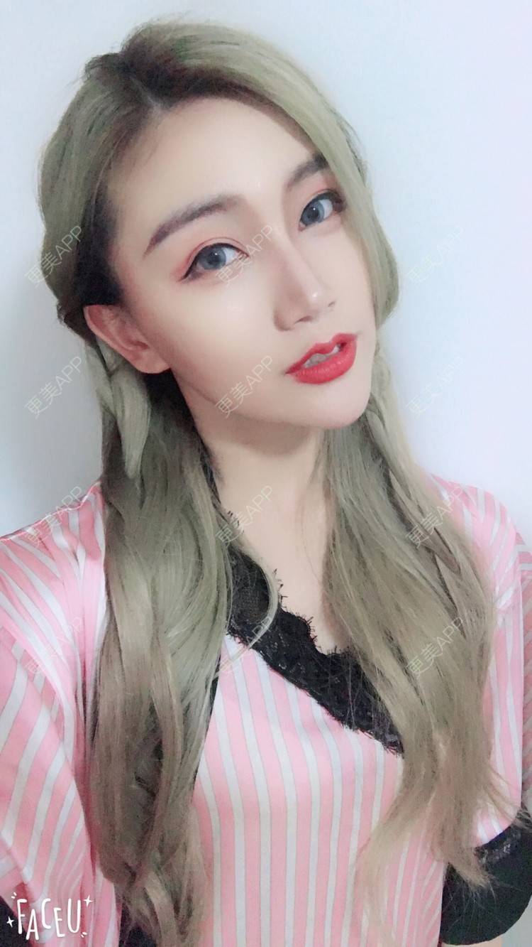 更美 - Bobbyya🌊的肋软骨隆鼻经验 | 肋软骨隆鼻 | 武汉