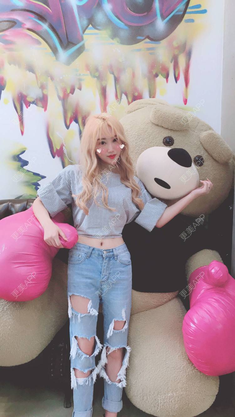 更美 - Bobbyya🌊的肋软骨隆鼻经验 | 肋软骨隆鼻 | 武汉