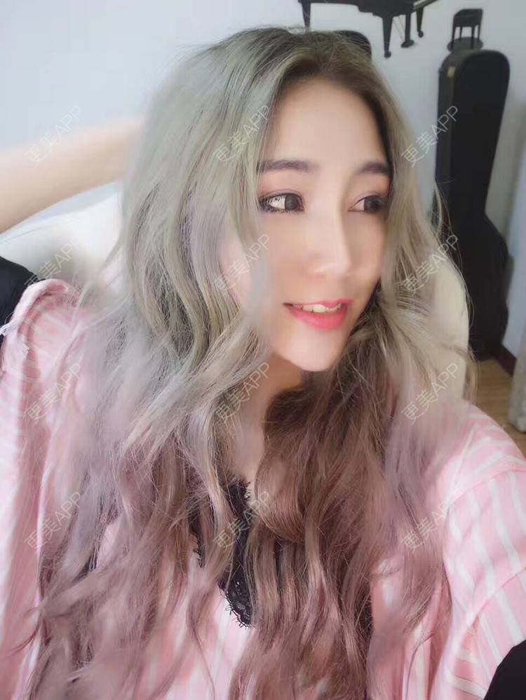 更美 - Bobbyya🌊的肋软骨隆鼻经验 | 肋软骨隆鼻 | 武汉